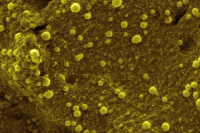 Nanopartículas metálicas depositadas sobre un polímero conductor | Universidad de Burgos