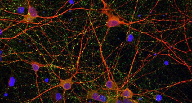 Imágenes de microscopía de cultivos de células neuronales.|IBB-CSIC.